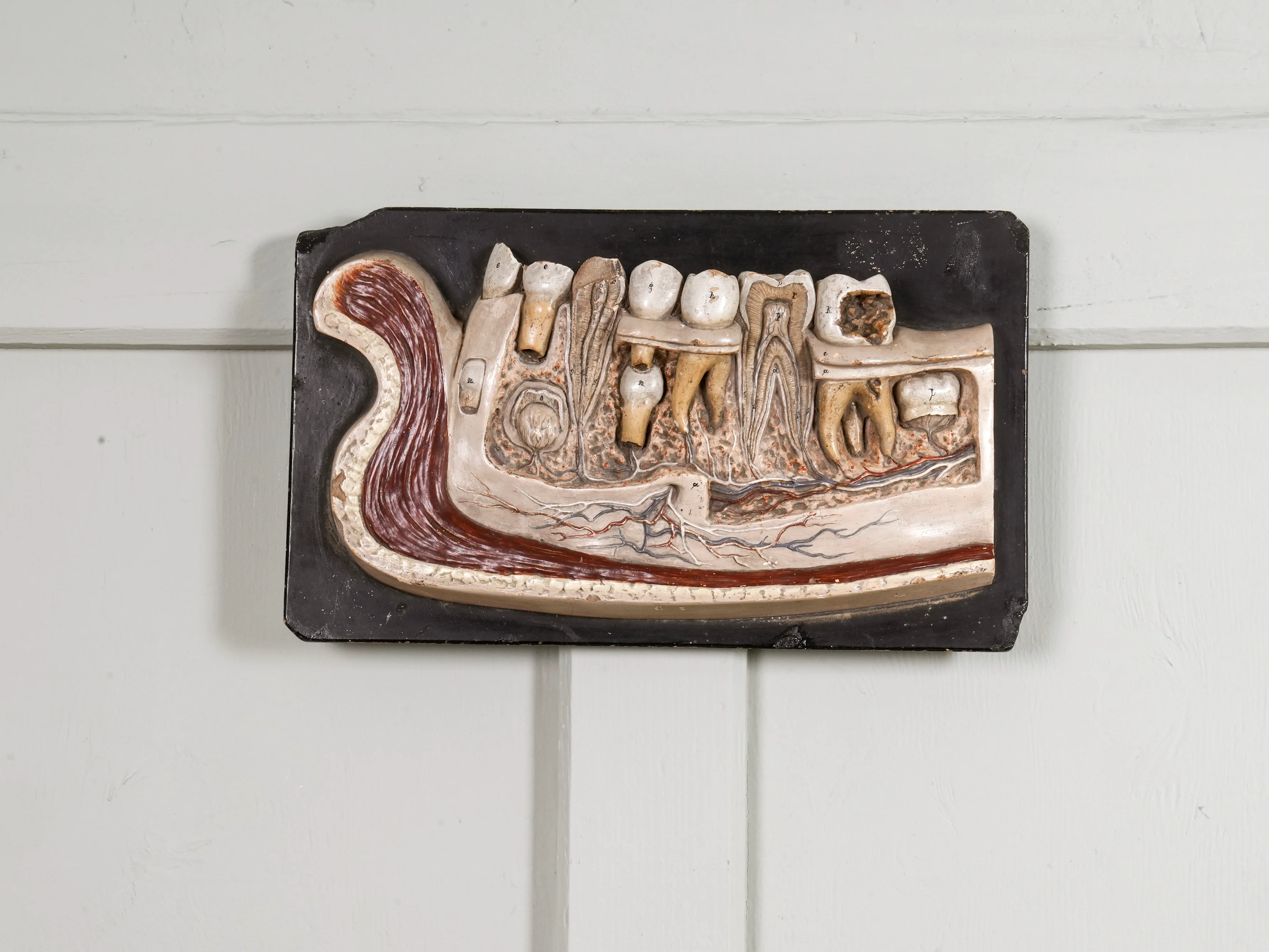 A 19th Century Plaster Didactic Model of Malformed Teeth - Image 3