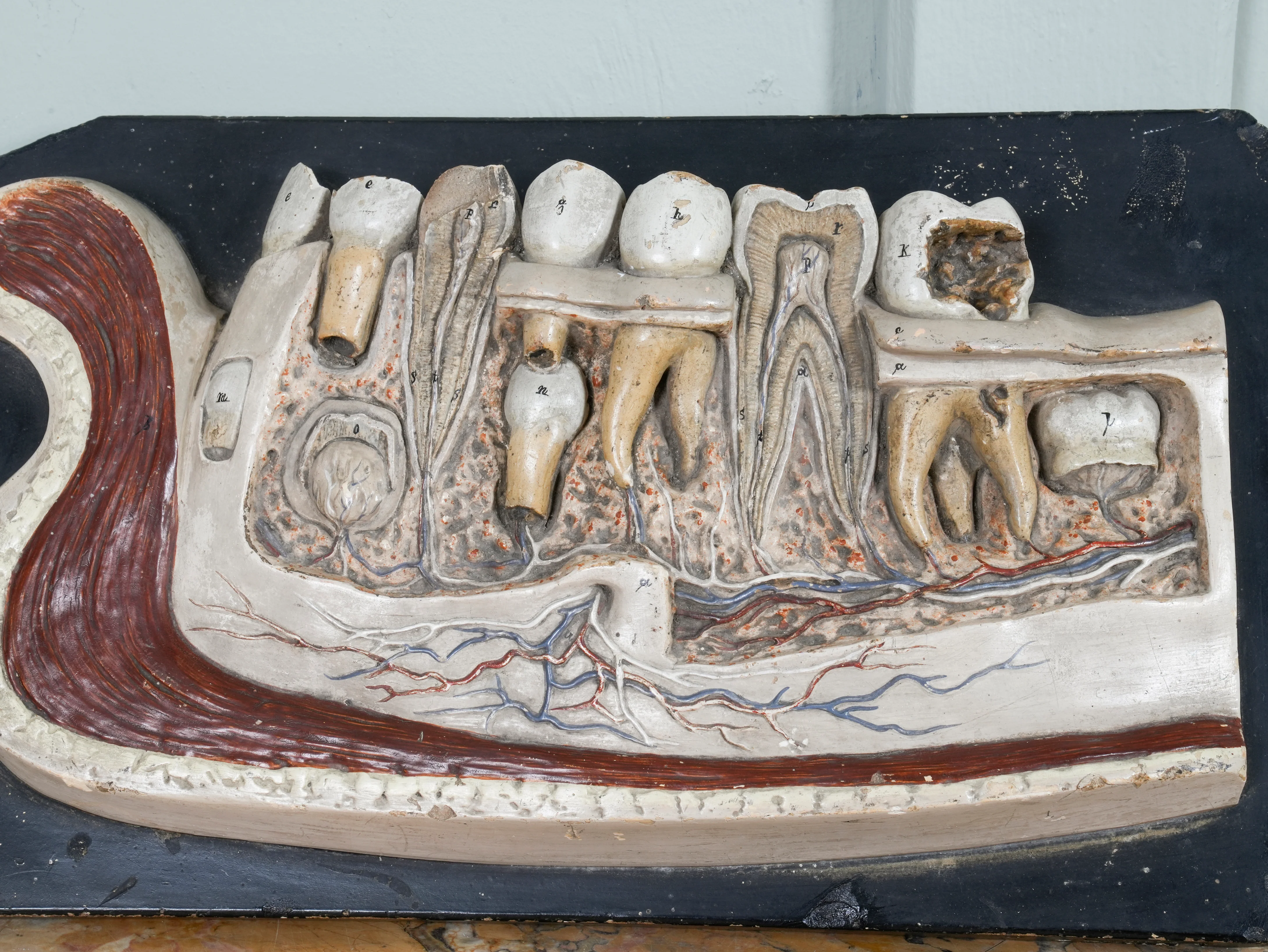 A 19th Century Plaster Didactic Model of Malformed Teeth - Image 5
