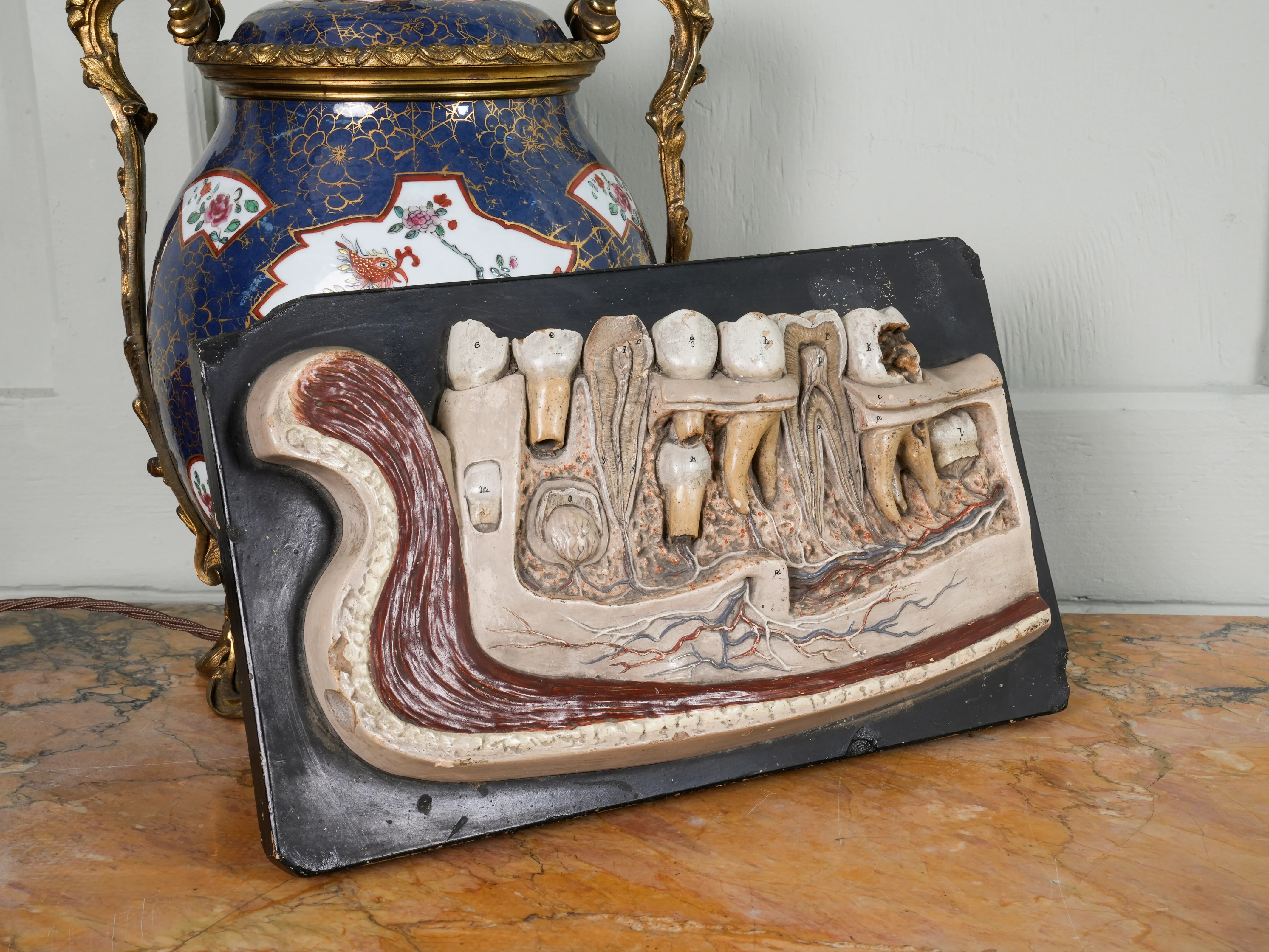 A 19th Century Plaster Didactic Model of Malformed Teeth - Image 9